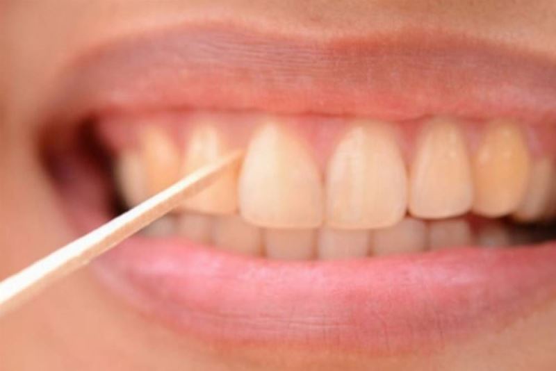 Kürdan ile dis temizligi dogru mu?