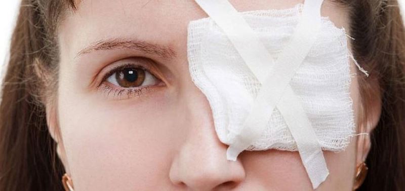 Göz yaralanmalari en çok temmuz ayinda görülüyor