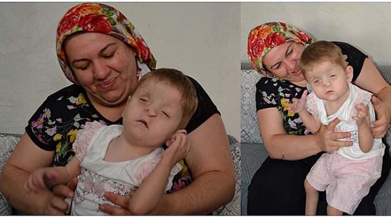 3 yasindaki Sevgi Hira Sahin, hayata tutunmaya çalisiyor